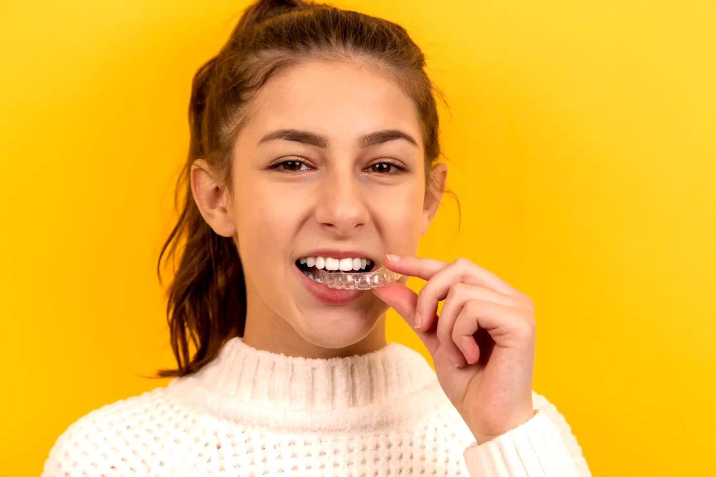 Diseño de Sonrisa