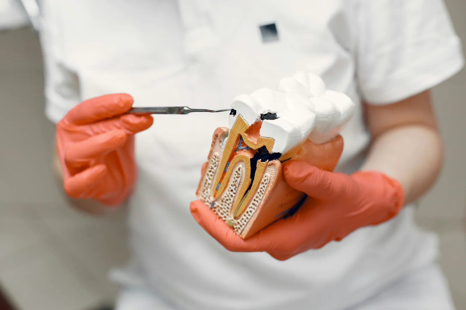 Endodoncia