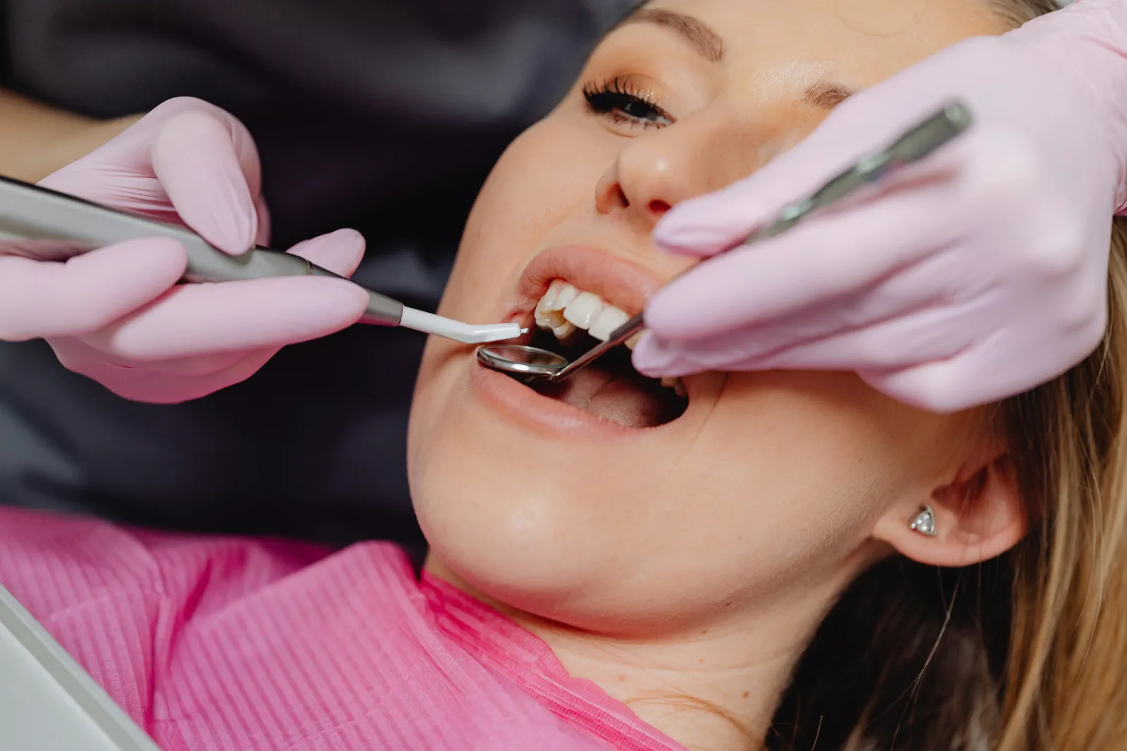 Limpieza Dental Profesional